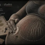 Vergeture grossesse : stades sur le ventre, crème et repères visuels